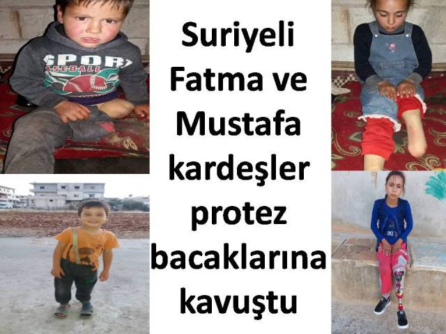 Suriyeli Fatma ve Mustafa Kardeşler Protez bacaklarına kavuştu